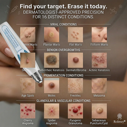 Rolimey® 7-Day Skin Tag & Blemish Remover Painless & Scar-Free – Advanced Mole & Wart Remover
